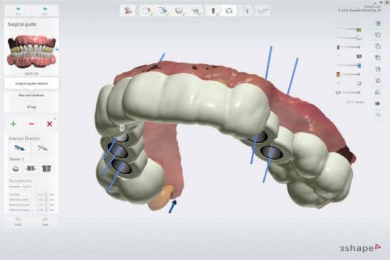 Digitally guided Surgery