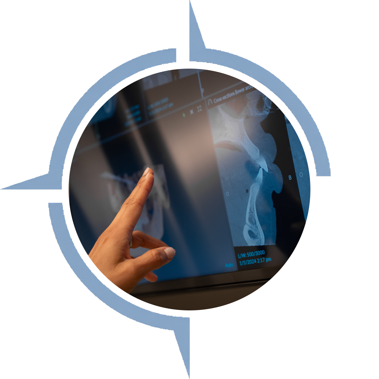 hand over xrays