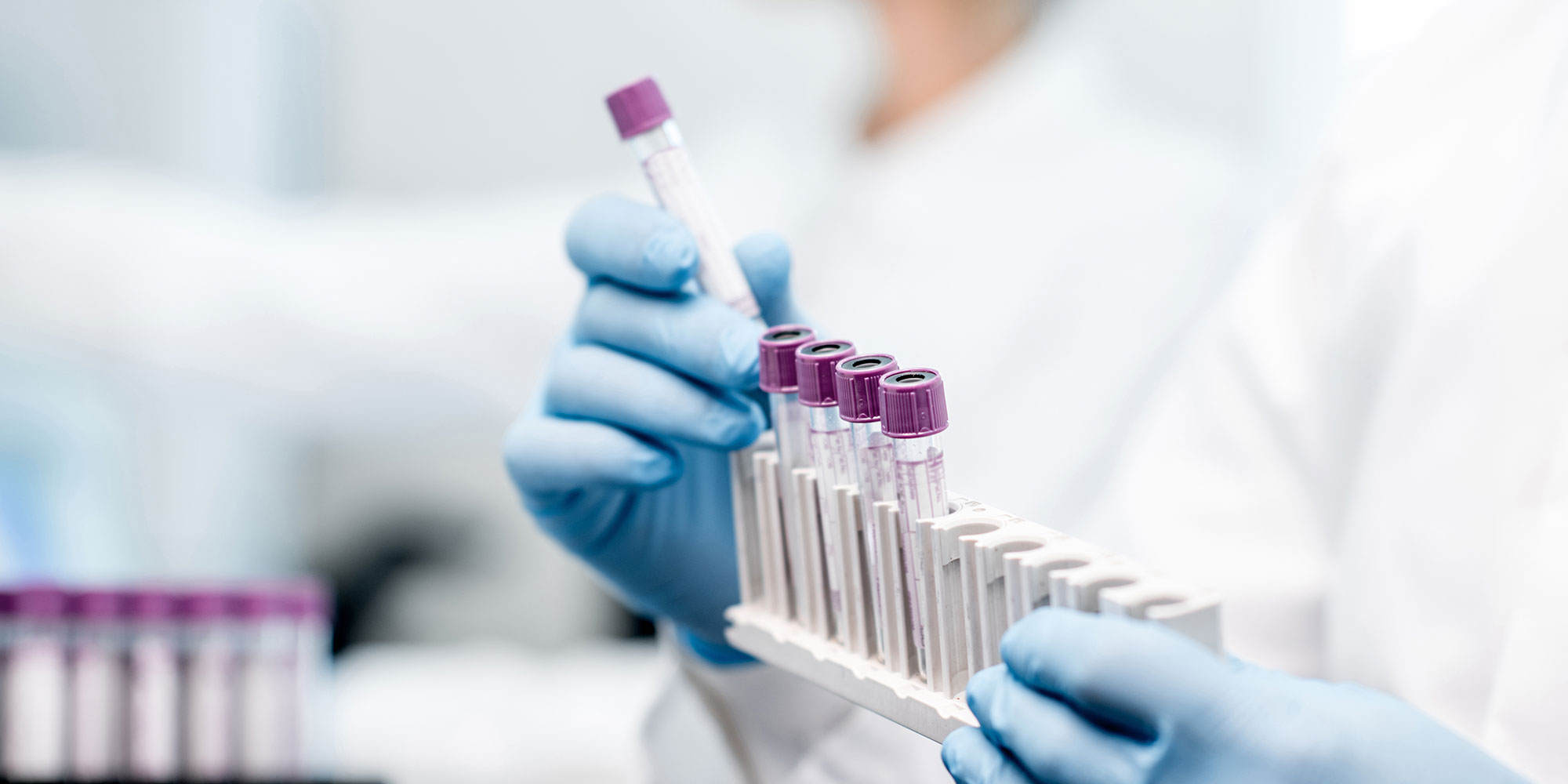 testing tubes for lab