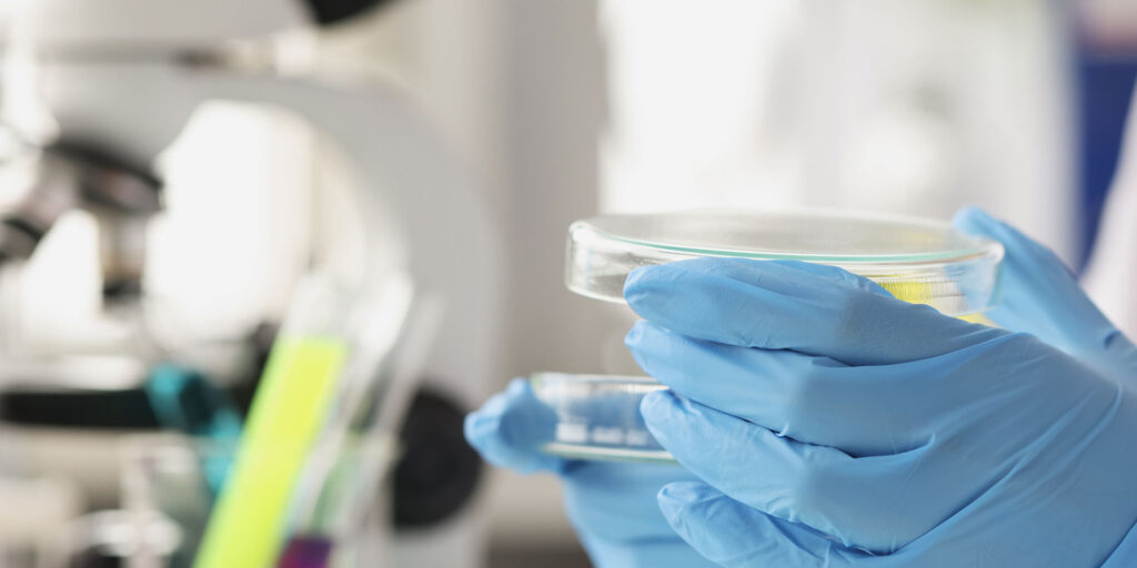 petri dish of test sample