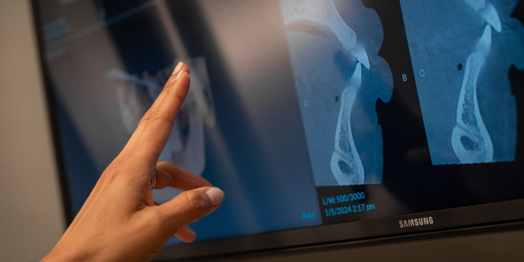 close up of dental scan hand